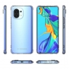 Wozinsky Anti Shock Durable Case Xiaomi Mi 11 - Transparent